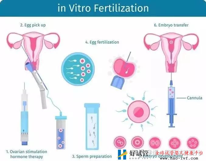 做一个试管婴儿要花多少钱医保能报销吗(图4) 做一个试管婴儿要花多少钱医保能报销吗(图4)