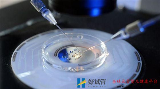 多囊卵巢综合症能做试管婴儿吗?(图2) 多囊卵巢综合症能做试管婴儿吗?(图2)