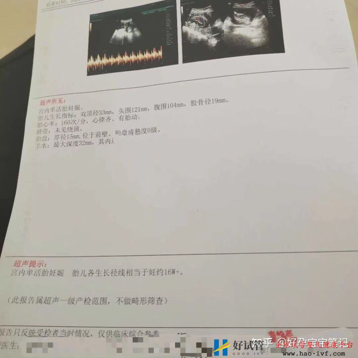 多囊多年至不孕,试管移植二次成功!经验分享!(图6) 多囊多年至不孕,试管移植二次成功!经验分享!(图6)