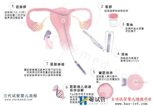 【干货】这张《第三代试管婴儿流程图》,一目了然,...(图1) 【干货】这张《第三代试管婴儿流程图》,一目了然,...(图1)