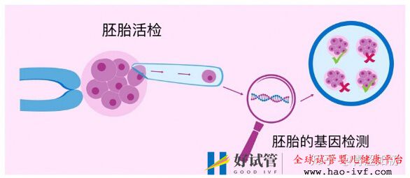 试管婴儿的利弊分析(图1) 试管婴儿的利弊分析(图1)