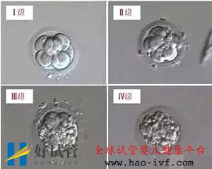 泰国试管婴儿鲜胚,囊胚,冻胚,哪个移植成功率更高(图2) 泰国试管婴儿鲜胚,囊胚,冻胚,哪个移植成功率更高(图2)