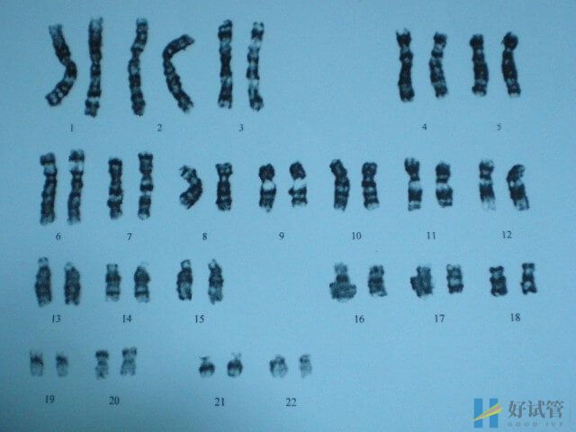女性染色体14pss会影响生育能力吗?(图1) 染色体14pss不会影响女性生育能力