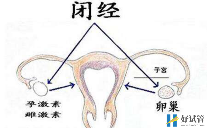 远离排卵障碍,教你几个小妙招有效预防(图3) 排卵障碍会影响女性月经