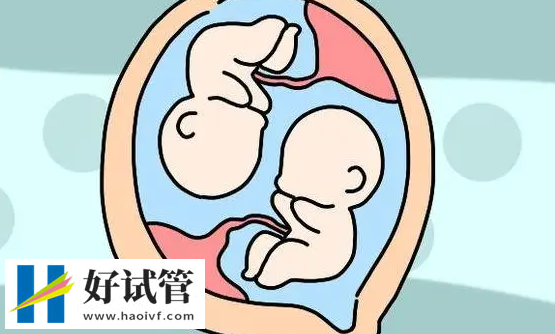 三代试管做双生子的条件,胚胎质量和卵巢功能好才能做(图1) 胚胎质量的才能做试管双生子