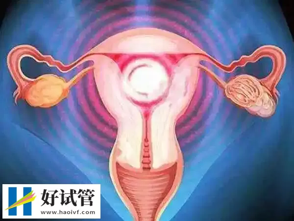 铜仁子宫腺肌症怀孕后保胎的方法是什么(图1) 子宫腺肌症想要怀孕很不容易
