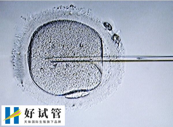 6aa囊胚的成功率高不高(图2) 6aa囊胚的成功有60%
